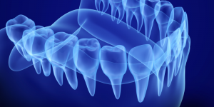 digital model of a lower jaw